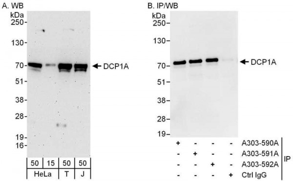 Anti-DCP1A