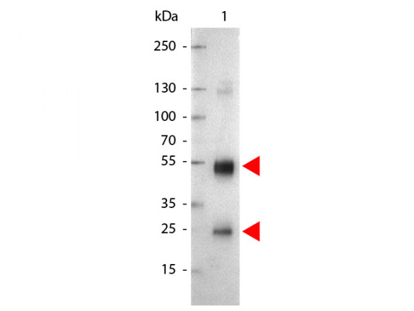 Anti-Rat IgG (H&amp;L) [Goat] Alkaline Phosphatase conjugated