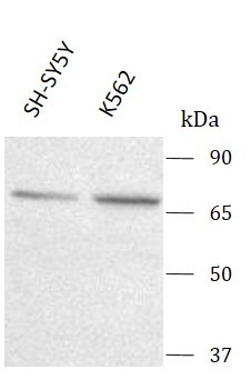 Anti-Opioid Receptor