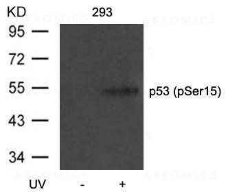 Anti-phospho-p53 (Ser15)