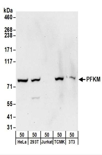 Anti-PFKM