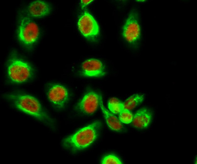 Anti-phospho-PP2A-Calpha (Tyr307)
