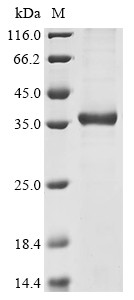 Probable G-protein coupled receptor 132 (GPR132), partial, human, recombinant