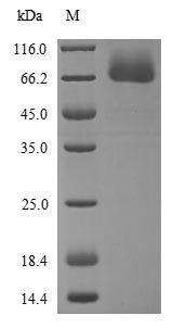 Proto-oncogene c-Rel (REL), partial, human, recombinant