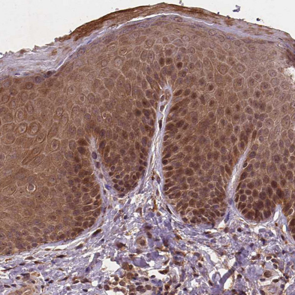 Anti-NIPAL2