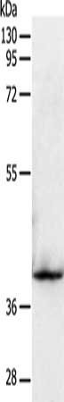Anti-SIRT2