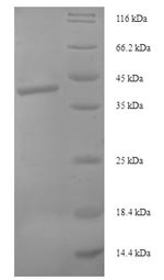 Syntaxin-10 (STX10), partial, human, recombinant
