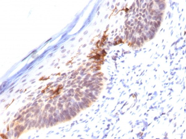 Anti-CD1a (Mature Langerhans Cells Marker), clone SPM120
