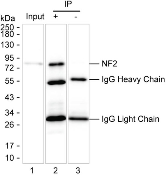 Anti-NF2