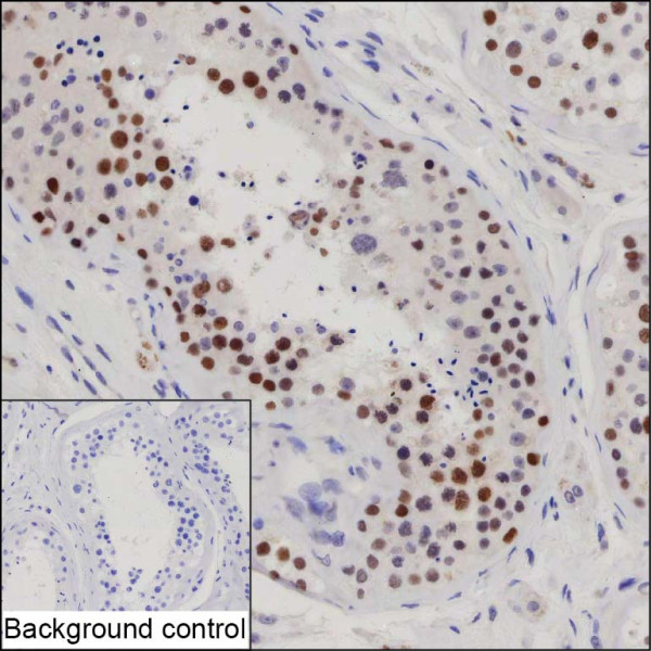 Anti-SBNO1