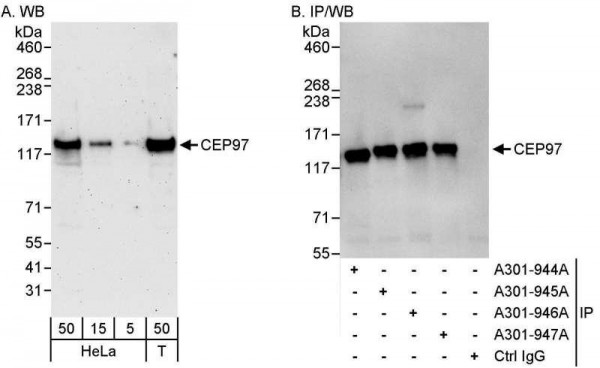 Anti-CEP97