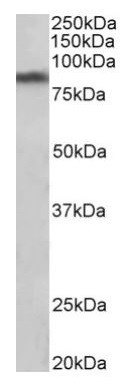 Anti-Dopamine Transporter