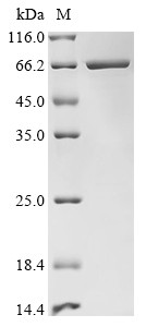 SHC-transforming protein 1 (SHC1), partial, Biotinylated, human, recombinant