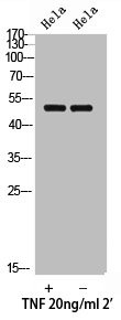 Anti-Phospho-SMAD3 (T179)