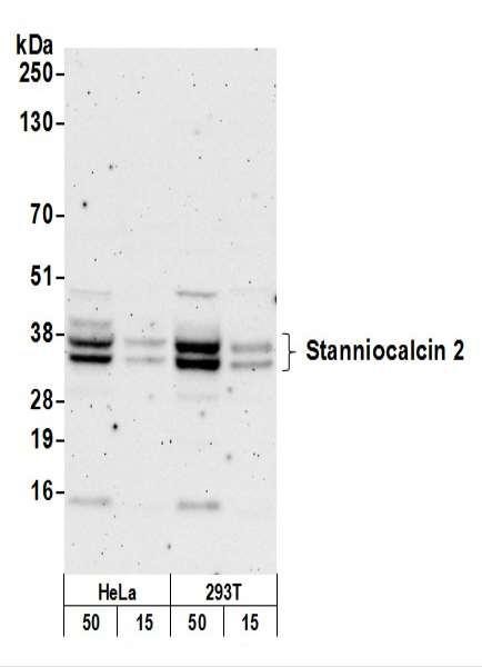 Anti-Stanniocalcin 2