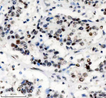 Anti-PHF8 / PHD finger protein 8, clone ADAI-16