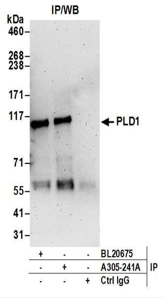Anti-PLD1/Phospholipase D1