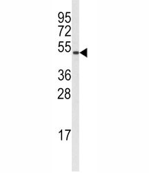 Anti-Cyclin B1 (CCNB1)