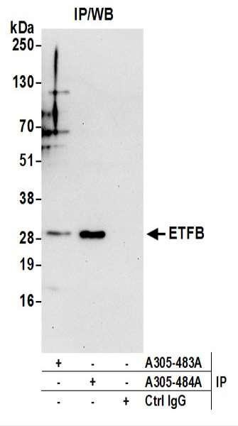 Anti-ETFB