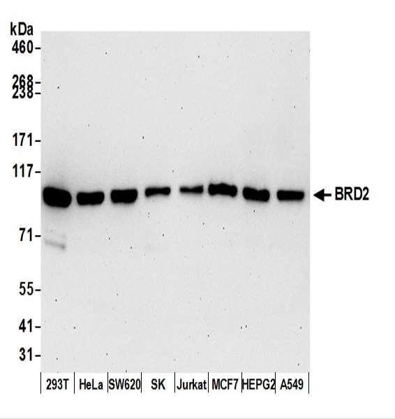 Anti-BRD2 Recombinant Monoclonal