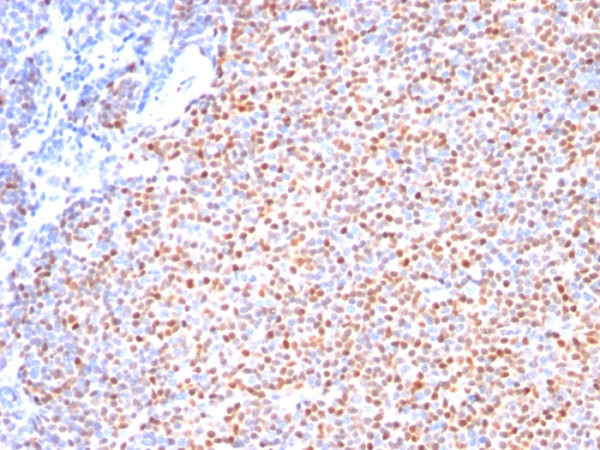 Anti-Cyclin D1 (G1-Cyclin &amp; Mantle Cell Marker), clone SPM587