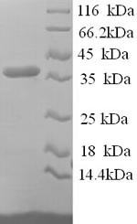 Reticulocalbin-1 (RCN1), partial, human, recombinant
