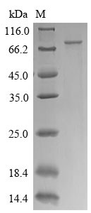 CTP synthase 1 (CTPS1), human, recombinant