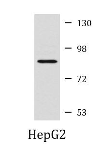 Anti-FSH Receptor