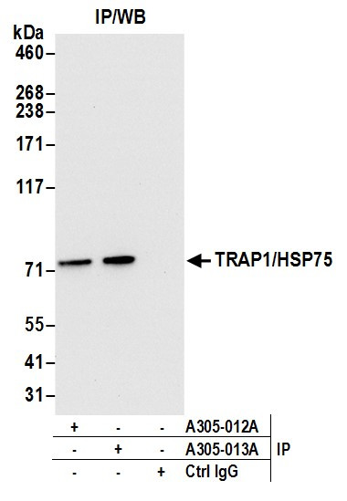 Anti-TRAP1/HSP75