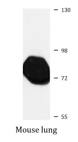 Anti-ACSS3