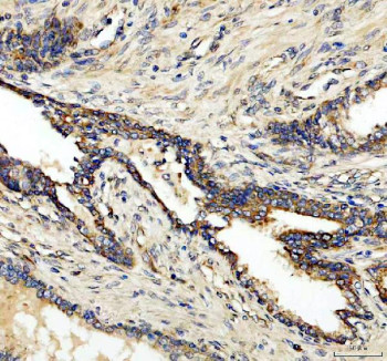Anti-CLCN3 / Chloride channel protein 3