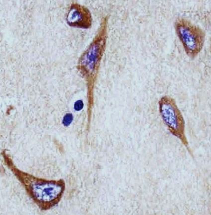 Anti-NPTX1 / NP1