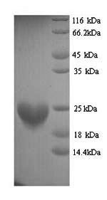 Histone H3-like centromeric protein A (Cenpa), mouse, recombinant