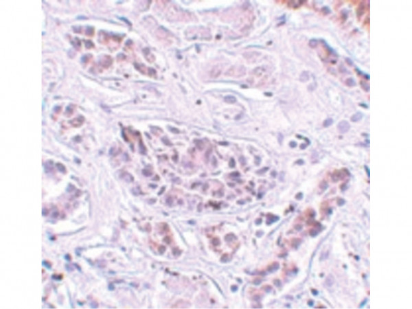 Anti-ATG3