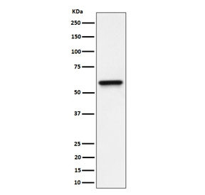Anti-Regulator of G-protein signaling 6 / RGS6, clone 29R02