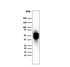 Anti-Thymidine Phosphorylase / PD-ECGF, clone TYMP/2890R