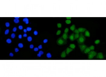 Anti-B-Myb / Myb-related protein B / MYBL2