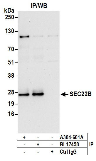 Anti-SEC22B