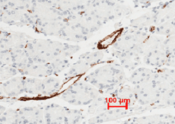 Anti-vWF Monoclonal Recombinant Antibody
