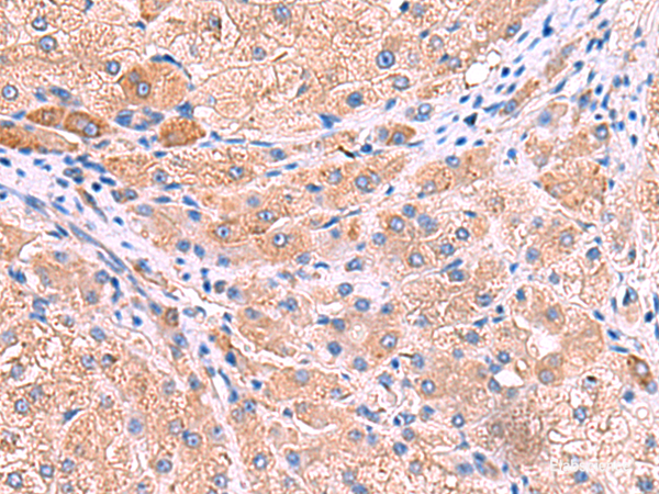 Anti-MPP1