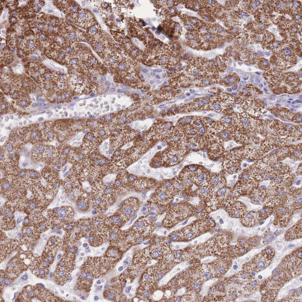 Anti-PCSK1