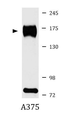 Anti-ZMYND8 / PRKCBP1