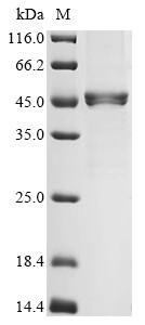 Actin, alpha cardiac muscle 1 (ACTC1),partial, human, recombinant