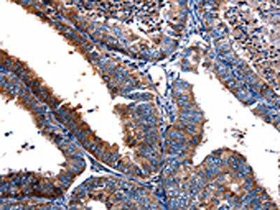 Anti-FPR2