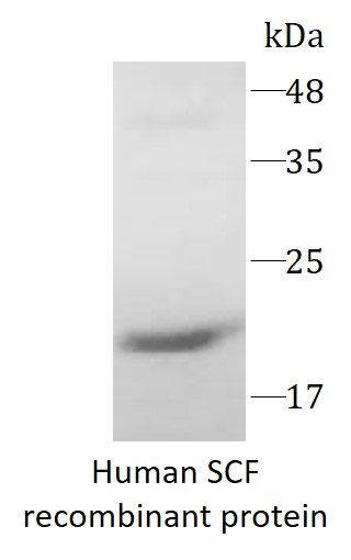 Human SCF recombinant protein (Active) (His-tagged)