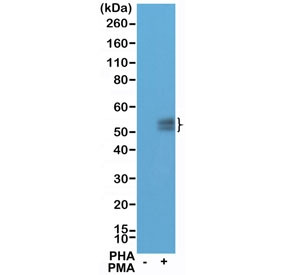 Anti-PDCD1 / PD-1 (N-Terminal) (recombinant antibody), clone RM309
