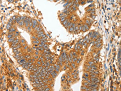 Anti-MMP28