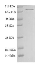 Neuroepithelial cell-transforming gene 1 protein (NET1), human, recombinant
