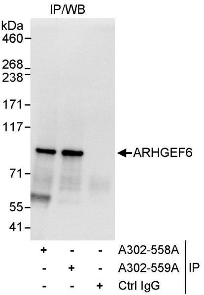 Anti-ARHGEF6