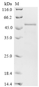 Collagen alpha-1 (XI) chain (COL11A1), partial, human, recombinant